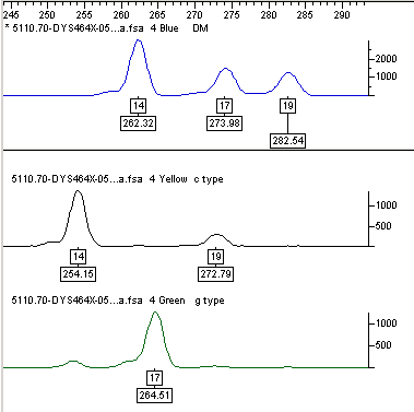 DYS464x as viewed in the electropherogram. Results 14, 14, 17, 19 DYS464x